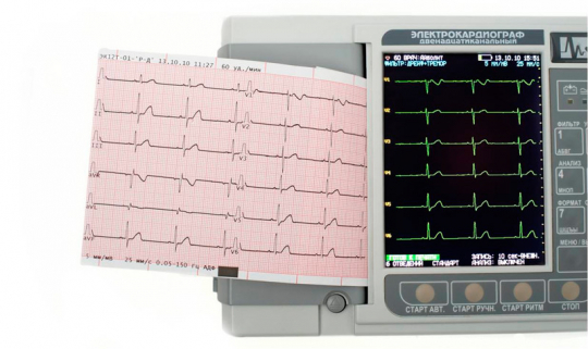 Электрокардиограф 3-6-12 канальный ЭК12Т-01-"Р-Д" (экран 141мм, G0200) - 4
